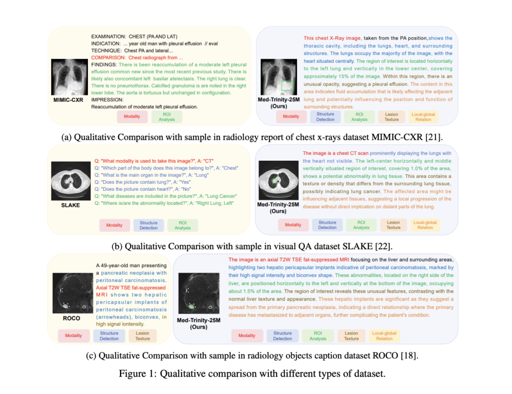 MedTrinity-25M: A Comprehensive Multimodal Medical Dataset with Advanced Annotations and Its Impact on Vision-Language Model Performance